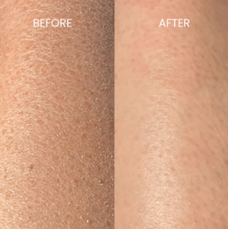 UltraSmooth™ Exfoliator Glove