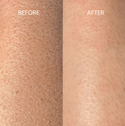 UltraSmooth™ Exfoliator Glove